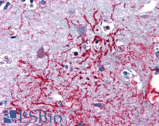 Anti-DHX58 antibody IHC of human brain, cortex. Immunohistochemistry of formalin-fixed, paraffin-embedded tissue after heat-induced antigen retrieval. Antibody LS-B2729 concentration 5 ug/ml.