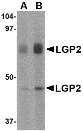 Western blot of LGP2 in rat kidney tissue lysate with LGP2 antibody at (A) 1 and (B) 2 ug/ml.