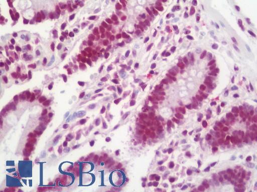 Anti-DHX8 antibody IHC staining of human small intestine. Immunohistochemistry of formalin-fixed, paraffin-embedded tissue after heat-induced antigen retrieval. Antibody LS-B11211 dilution 1:100.
