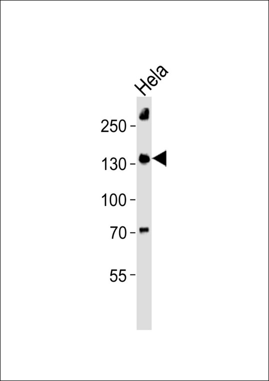 Western blot of lysate from HeLa cell line with DHX8 Antibody. Antibody was diluted at 1:1000. A goat anti-rabbit IgG H&L (HRP) at 1:10000 dilution was used as the secondary antibody. Lysate at 35 ug.