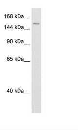 Transfected 293T Cell Lysate
