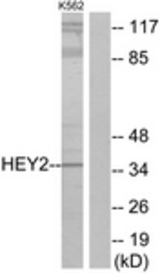 Western blot of extracts from K562 cells, using HEY2 Antibody. The lane on the right is treated with the synthesized peptide.
