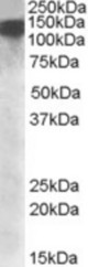 DHX9 antibody (1 ug/ml) staining of nuclear HeLa lysate (35 ug protein/ml in RIPA buffer). Primary incubation was 1 hour. Detected by chemiluminescence.