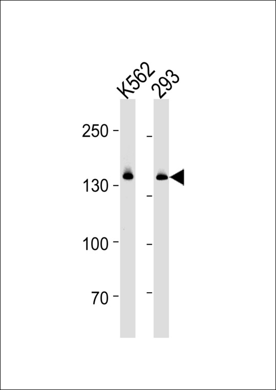 DHX9 Antibody western blot of K562 and 293 cell line lysates (35 ug/lane). The DHX9 antibody detected the DHX9 protein (arrow).