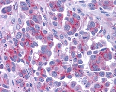 Immunohistochemistry of Smac/DIABLO in human ovary tissue with Smac antibody at 5 ug/ml.