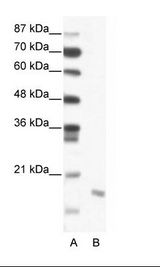 A: Marker, B: Jurkat Cell Lysate