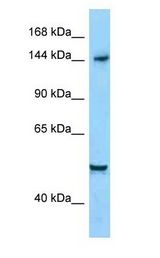 DIAPH1 antibody Western Blot of HepG2.