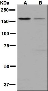 Western blot analysis on (A) K562 and (B) 293T cell lysates using anti-DIAPH1 antibody.