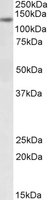 DIAPH1 antibody (0.3 ug/ml) staining of NIH3T3 lysate (35 ug protein/ml in RIPA buffer). Primary incubation was 1 hour. Detected by chemiluminescence.