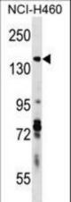 DIAPH3 Antibody western blot of NCI-H460 cell line lysates (35 ug/lane). The DIAPH3 antibody detected the DIAPH3 protein (arrow).