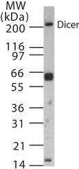 Western blot of 15 ug of mouse ovary tissue lysate with anti-mouse Dicer at 1:1000 dilution.