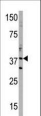 Western blot of anti-DIMT1 antibody in T47D cell line lysate (35 ug/lane). DIMT1(arrow) was detected using the purified antibody.