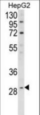 Western blot of DIO1 Antibody in HepG2 cell line lysates (35 ug/lane). DIO1 (arrow) was detected using the purified antibody.