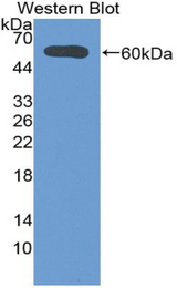 Western blot of recombinant DIO2.