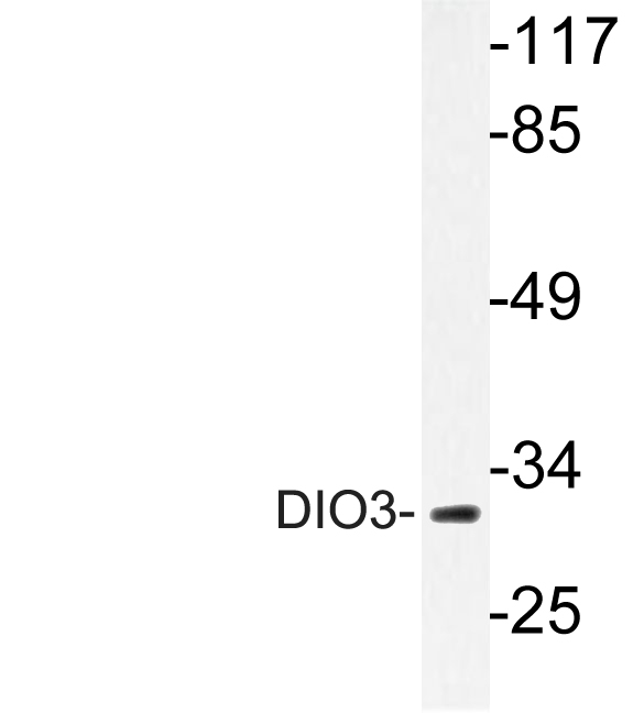 Western blot of DIO3 antibody in extracts from HUVEC cells.