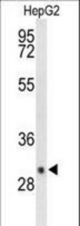Western blot of DIO3 Antibody in HepG2 cell line lysates (35 ug/lane). DIO3 (arrow) was detected using the purified antibody.