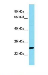 Western blot of Jurkat. DIRAS2 antibody dilution 1.0 ug/ml.