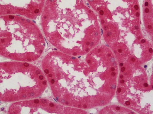 Human Kidney: Formalin-Fixed, Paraffin-Embedded (FFPE)