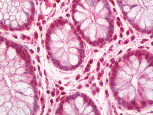 Human Colon: Formalin-Fixed, Paraffin-Embedded (FFPE)
