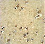 DIRAS3 Antibody immunohistochemistry of formalin-fixed and paraffin-embedded human brain tissue followed by peroxidase-conjugated secondary antibody and DAB staining.