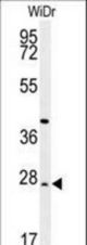 DIRAS3 Antibody western blot of WiDr cell line lysates (35 ug/lane). The DIRAS3 antibody detected the DIRAS3 protein (arrow).