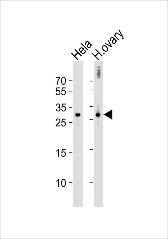 Western blot of lysates from HeLa cell line and human ovary tissue lysate (from left to right), using DIRAS3 Antibody. Antibody was diluted at 1:1000 at each lane. A goat anti-rabbit IgG H&L (HRP) at 1:10000 dilution was used as the secondary antibody. Lysates at 35ug per lane.