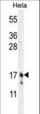 CLDN7 Antibody western blot of HeLa cell line lysates (35 ug/lane). The CLDN7 antibody detected the CLDN7 protein (arrow).
