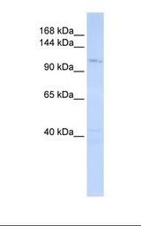 721_B cell lysate. Antibody concentration: 1.0 ug/ml. Gel concentration: 6-18%.