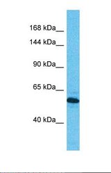 Western blot of Human Esophagus Tumor. DIS3 antibody dilution 1.0 ug/ml.