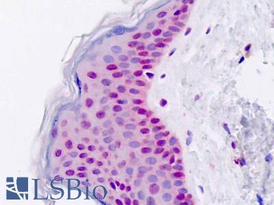Human, Skin; Formalin-Fixed Paraffin-Embedded (FFPE)