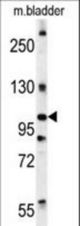 DIS3 Antibody western blot of mouse bladder tissue lysates (15 ug/lane). The DIS3 antibody detected DIS3 protein (arrow).