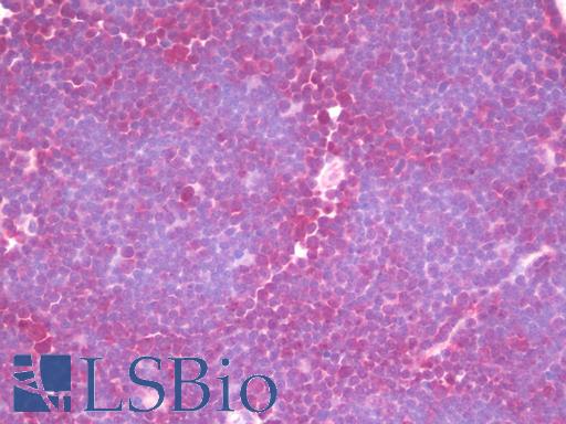 Anti-DIS3 antibody IHC staining of human thymus. Immunohistochemistry of formalin-fixed, paraffin-embedded tissue after heat-induced antigen retrieval. Antibody LS-B10106 concentration 10 ug/ml.