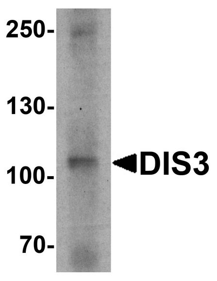 Western blot analysis of DIS3 in human ovary tissue lysate with DIS3 antibody at 1 ug/ml.