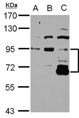 Sample (30 ug of whole cell lysate) A: NT2D1 B: IMR32 C: U87-MG 7.5% SDS PAGE DIS3L2 antibody diluted at 1:3000