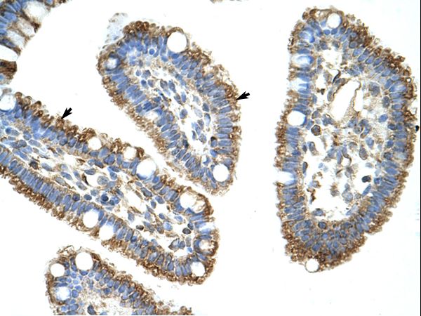 DIS3L2 antibody LS-C31330 was used in IHC to stain formalin-fixed, paraffin-embedded human intestine.