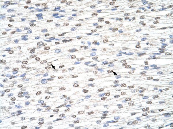 DIS3L2 antibody LS-C31331 was used in IHC to stain formalin-fixed, paraffin-embedded human heart.