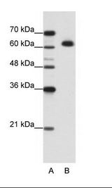 B: Jurkat Cell Lysate