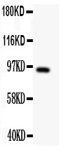 DISC1 antibody Western blot. All lanes: Anti DISC1 at 0.5 ug/ml. WB: U87 Whole Cell Lysate at 40 ug. Predicted band size: 94 kD. Observed band size: 94 kD.