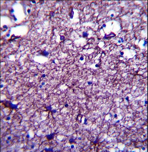 DISC1 Antibody immunohistochemistry of formalin-fixed and paraffin-embedded human brain tissue followed by peroxidase-conjugated secondary antibody and DAB staining.