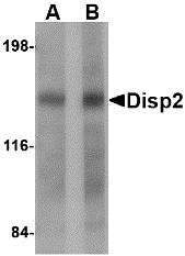 Western blot of Disp2 in rat brain tissue lysate with Disp2 antibody at (A) 1 and (B) 2 ug/ml
