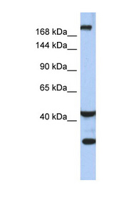 DISP1 / DISPA antibody LS-C111254 Western blot of Fetal Small Intestine lysate.