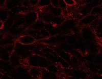 DISP1 antibody (2.5 ug/ml) staining of U87. Detected by immunofluorescence.