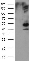 HEK293T cells were transfected with the pCMV6-ENTRY control (Left lane) or pCMV6-ENTRY DIXDC1 (Right lane) cDNA for 48 hrs and lysed. Equivalent amounts of cell lysates (5 ug per lane) were separated by SDS-PAGE and immunoblotted with anti-DIXDC1.
