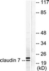 Western blot of extracts from 293 cells, using Claudin 7 Antibody. The lane on the right is treated with the synthesized peptide.