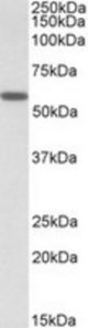 DIXDC1 antibody (0.5 ug/ml) staining of Human Skeletal Muscle lysate (35 ug protein in RIPA buffer). Primary incubation was 1 hour. Detected by chemiluminescence.