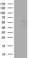 HEK293T cells were transfected with the pCMV6-ENTRY control (Left lane) or pCMV6-ENTRY DIXDC1 (Right lane) cDNA for 48 hrs and lysed. Equivalent amounts of cell lysates (5 ug per lane) were separated by SDS-PAGE and immunoblotted with anti-DIXDC1.