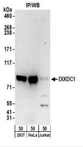 Detection of Human DIXDC1 by Western Blot. Samples: Whole cell lysate (50 ug) from 293T, HeLa, and Jurkat cells. Antibodies: Affinity purified rabbit anti-DIXDC1 antibody used for WB at 0.4 ug/ml. Detection: Chemiluminescence with an exposure time of 3 minutes.