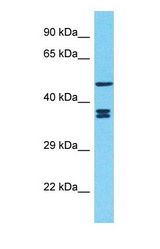 Western blot of DIXDC1 Antibody with human 786-0 Whole Cell lysate.