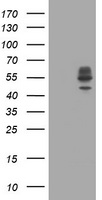 HEK293T cells were transfected with the pCMV6-ENTRY control (Left lane) or pCMV6-ENTRY DIXDC1 (Right lane) cDNA for 48 hrs and lysed. Equivalent amounts of cell lysates (5 ug per lane) were separated by SDS-PAGE and immunoblotted with anti-DIXDC1.