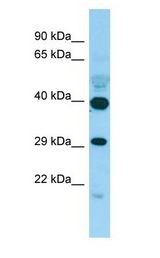 DJ858B16.2 / PISD antibody Western Blot of Fetal Brain.